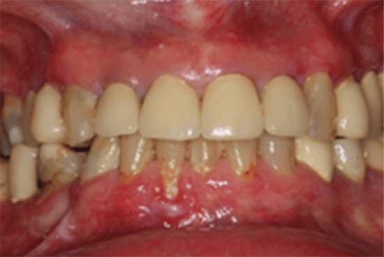 dental procedure before image